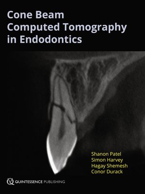 cover image of Cone Beam Computed Tomography in Endodontics